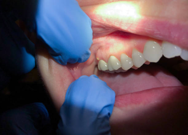 Best Tooth Pain Emergency Relief  in Prince George, VA